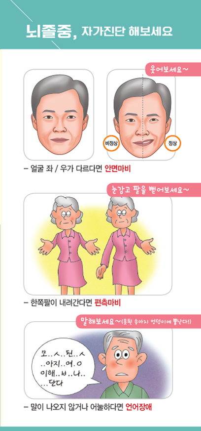 뇌졸중, 자가진단해보세요